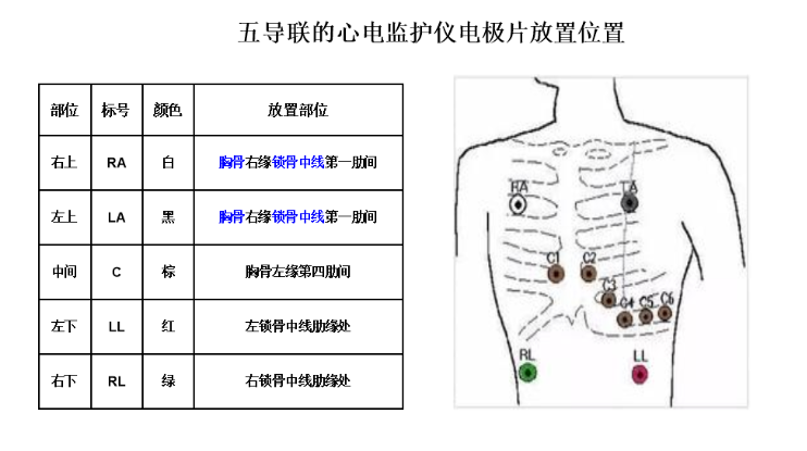 膈肌起搏器的作用及忌癥是什么?